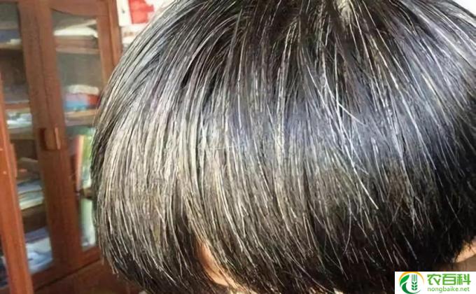 吃什么能让白头发变黑(黑发再现 好吃做法）