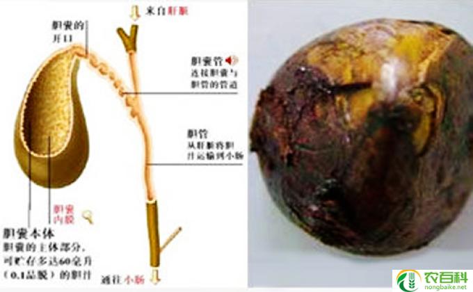 胆囊结石什么不能吃